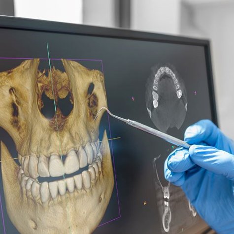 Scan of patient’s jaws and teeth displayed on computer monitor