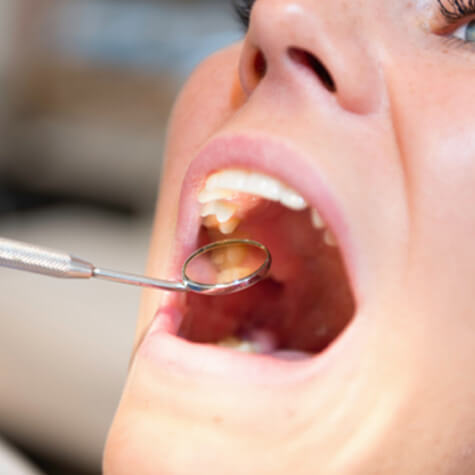 closeup of a woman having a dental checkup